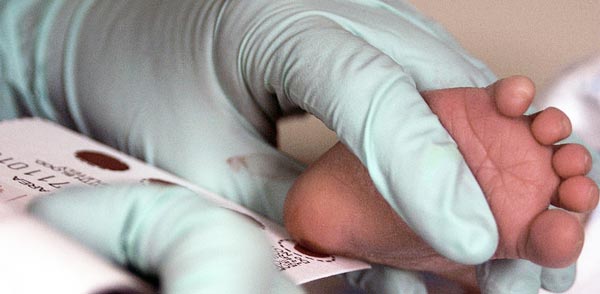 Screenincg neonatali